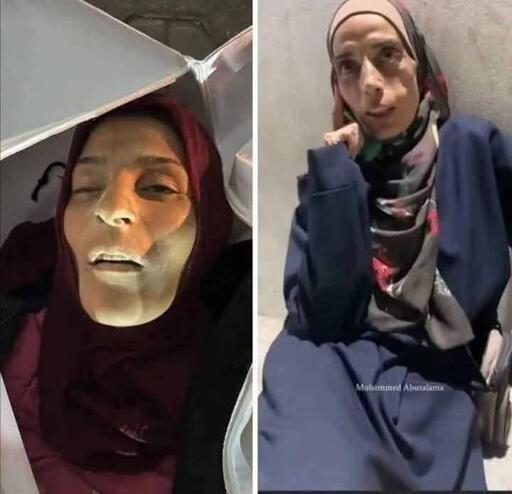She was pleading that she was dying of hunger, and she died of hunger. This is what's happening in Gaza. Please help me. I don't want this to happen again.Something for my children 🇵🇸